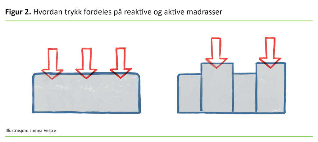 Figur 2. Hvordan trykk fordeles på reaktive og aktive madrasser