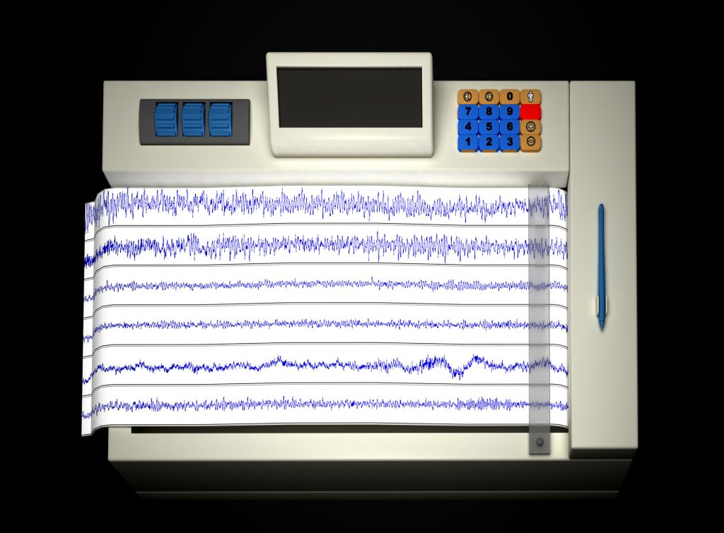 Illustrasjon av en EEG